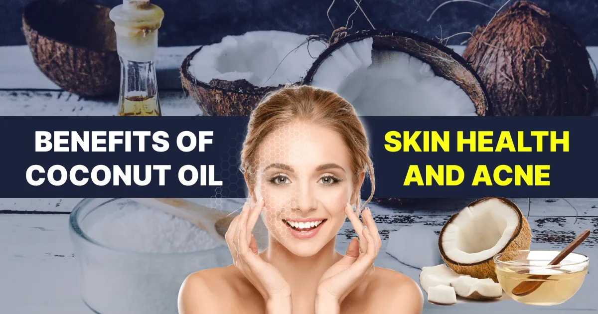 Benefits of Coconut Oil Skin Health and Acne